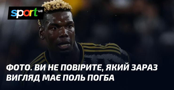 Знімок. Ви будете здивовані, як виглядає Поль Погба в даний момент!